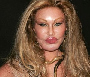 Jocelyn-Wildenstein